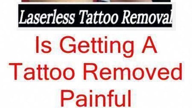 Laser Tattoo Removal Is A Cool Solution