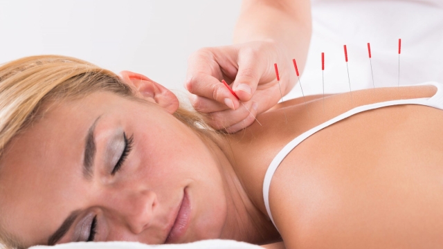 Sticking to Wellness: The Transformative Power of Acupuncture